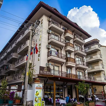 酒店 奥巴时代酒店 阿拉尼亚